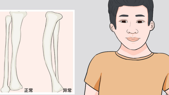 孩子不长个？这些原因你知道吗