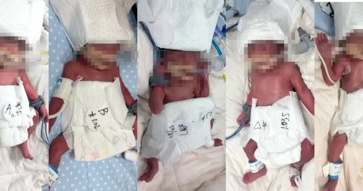 5胞胎（1男4女）顺利出生！六千万分之一概率的奇迹！